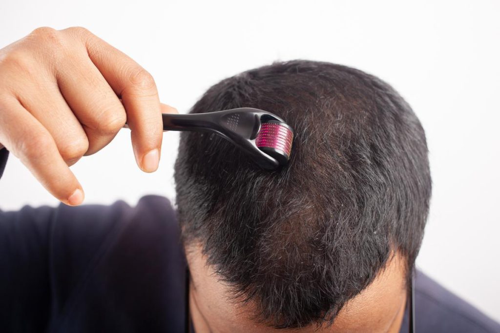 Benefit Of Derma Roller For Hair Growth And How To Use AndSons SG
