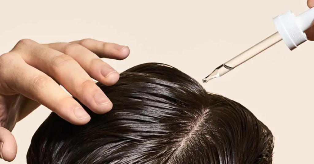 Difference Between Hair Vitamins Vs. Topical Hair Loss Treatments