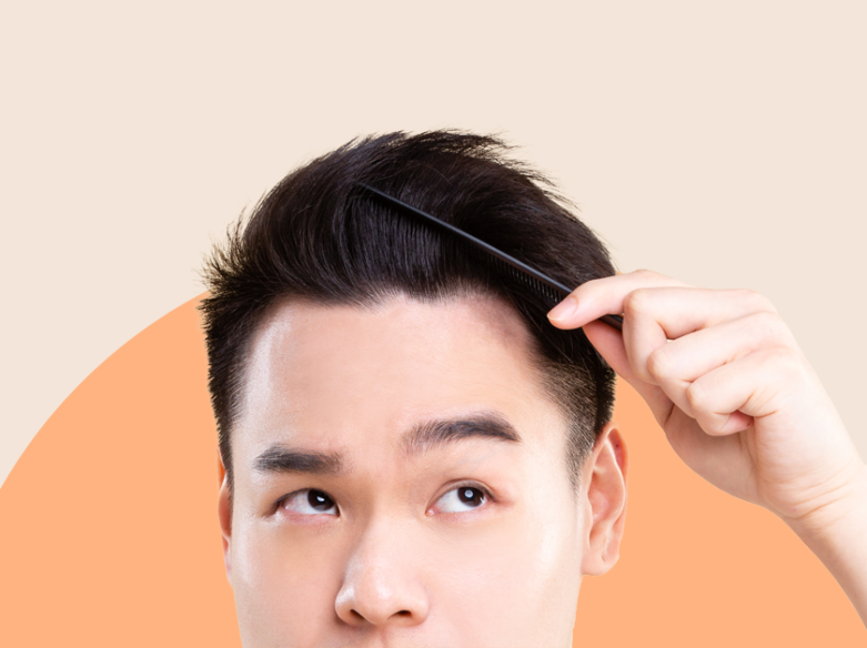 8 Best Hair Loss Treatments For Men In 2023 Andsons Sg